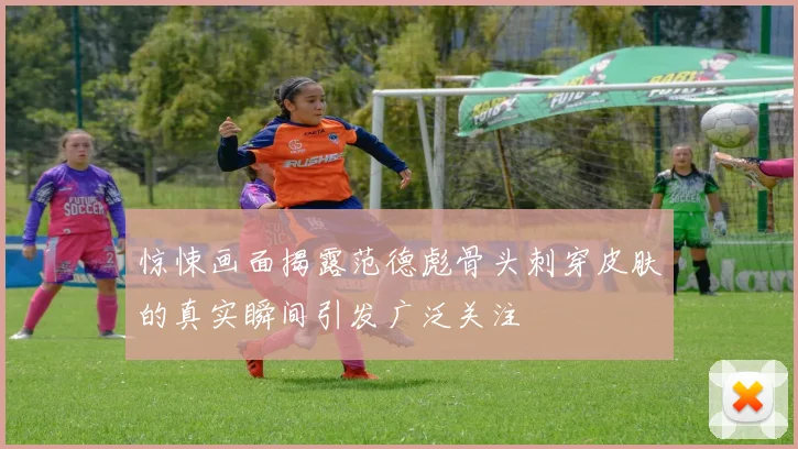 惊悚画面揭露范德彪骨头刺穿皮肤的真实瞬间引发广泛关注